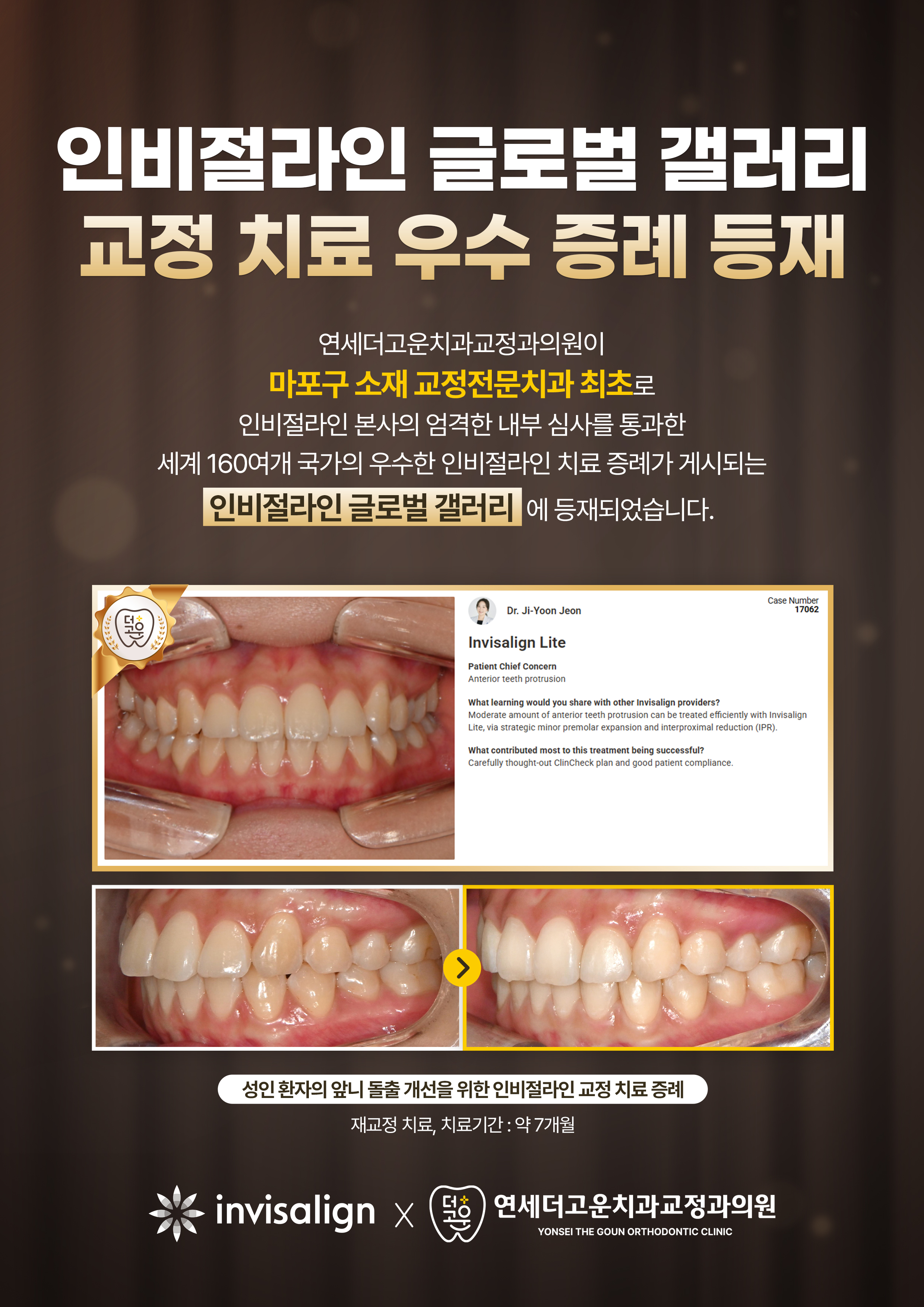 9c2cf6571c291c6c0cc4cd63eb5b835c_1775807158_1986.jpg 9c2cf6571c291c6c0cc4cd63eb5b835c_1775807158_1986.jpg